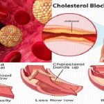 How to lower blood cholesterol levels