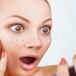 Adult Acne: The Myths About Acne Flair-Ups Debunked!